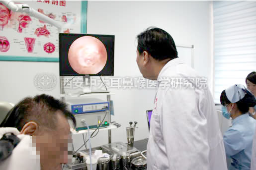 ���߽�������Ĥ���׵������Ʒ�