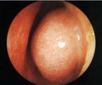 ҽ��ָ�����ʺ��Ա�������Щԭ���Ѳ��˸�ϵ��