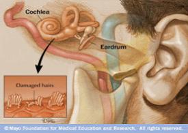 【治疗】治疗耳朵流脓哪家医院好?
