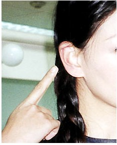 权威医生提醒:注意保护耳朵,远离耳硬化症