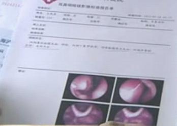 鼻炎嗅觉失灵典型案例解读