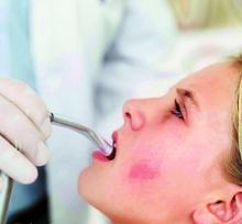 生活中怎样预防咽喉炎