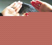 惊!耳部疱疹致失明!