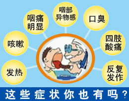 咽炎的症状你有哪些?